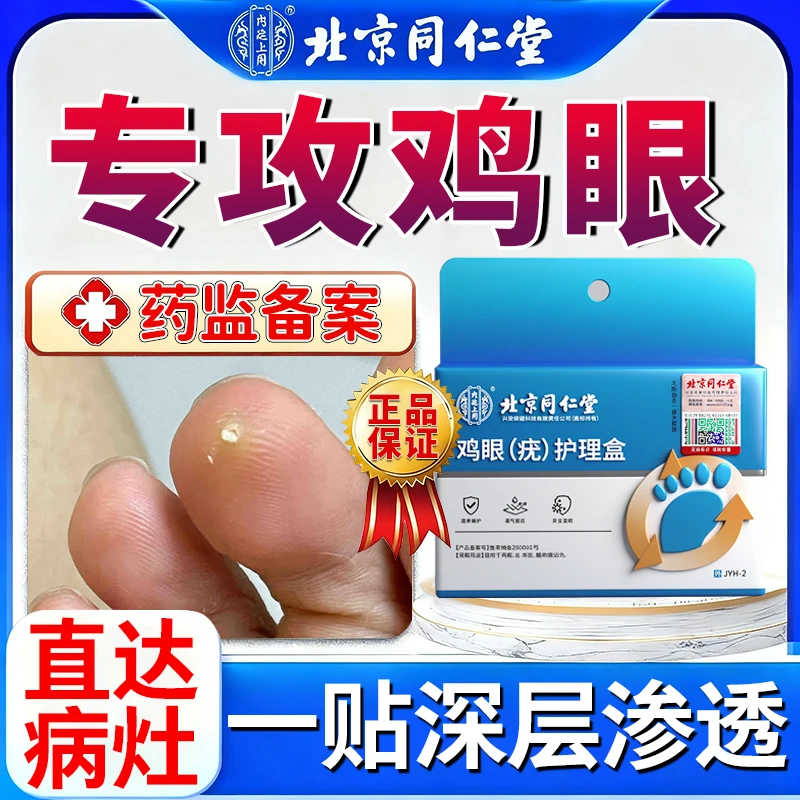 北京同仁堂鸡眼贴鸡眼怎么去改善手上脚趾脚后跟长肉茧跖疣瘊改善鸡眼按压疼痛内廷上用鸡眼(疣)护理盒