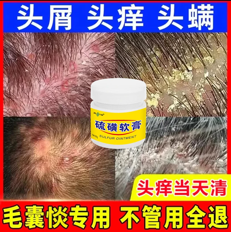 硫磺膏毛囊膏马拉色菌前胸后背头皮毛囊小疙瘩红点红痘痘草本抑菌