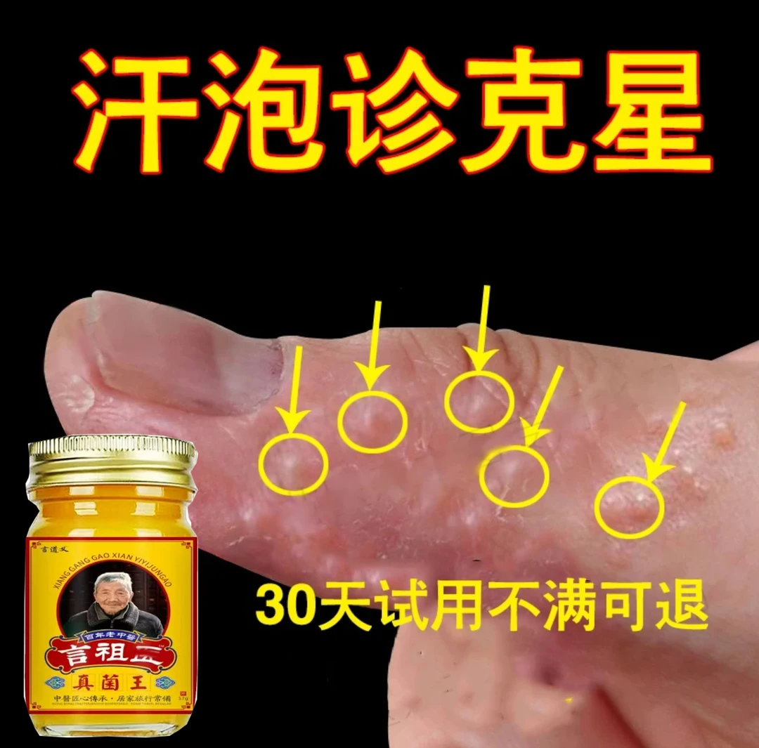 手上起小水泡外用涂抹手指手缝红痒渗液脱皮止痒清凉护理草本乳膏