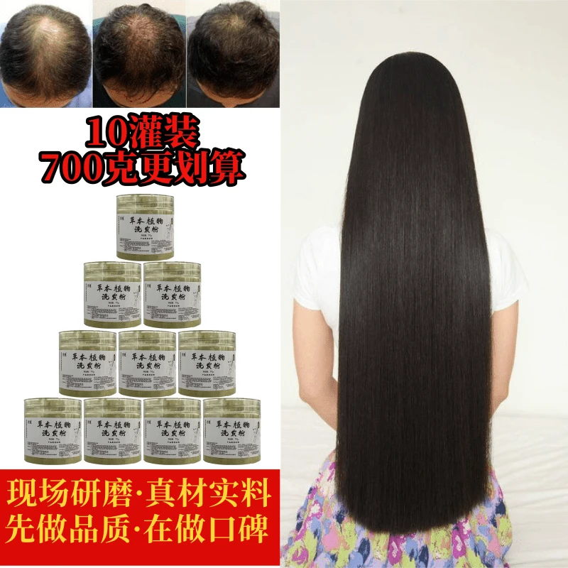 养发护发专用【疗程装】头油头屑头痒防脱细软塌【老粉丝都在选这个】