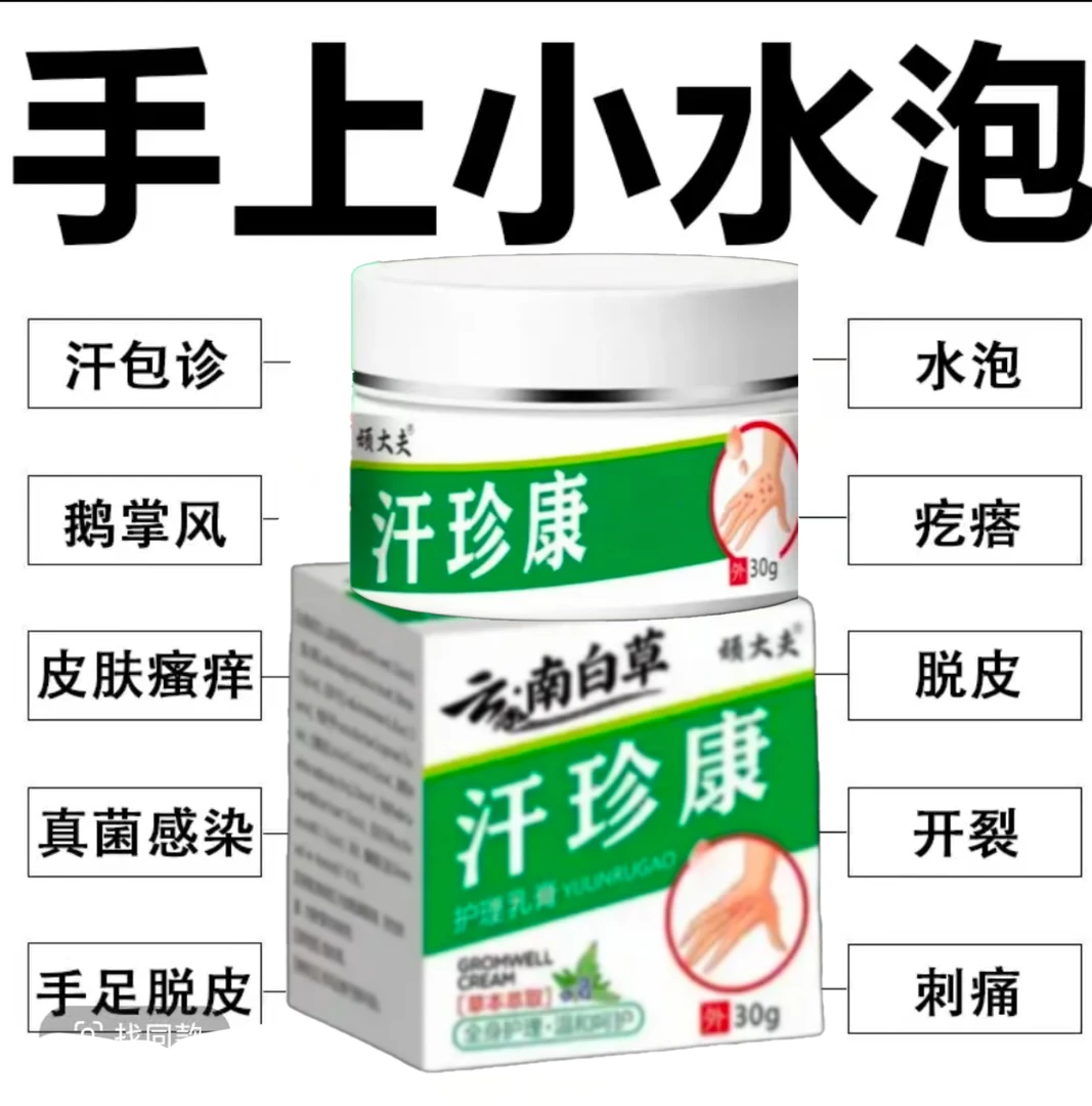 汗泡诊专用手上起小水泡止痒膏脱皮手指缝痒干裂专用草本