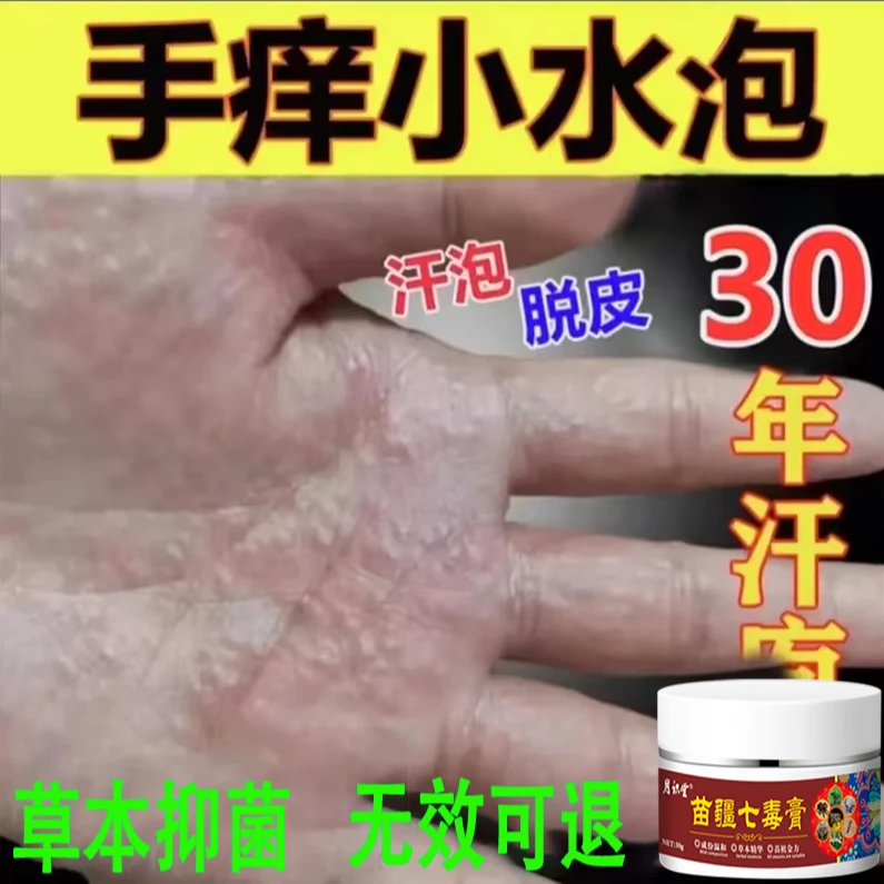 手起脚小水泡止痒神器王脱皮抑菌克星手指间痒干裂专用外用抑菌膏