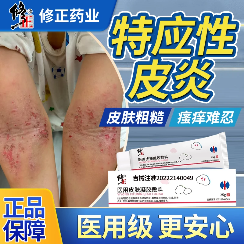 修正医用皮肤凝胶敷料特应性皮炎肘窝膝盖窝皮肤瘙痒红斑干燥qu