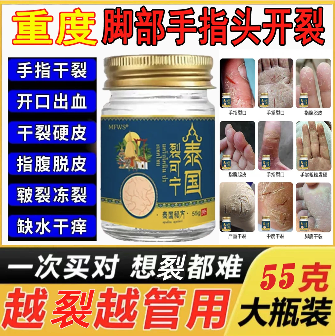 裂可宁脚部重度裂口子出血手足脱皮痒干裂开裂防裂修复舒缓护肤膏