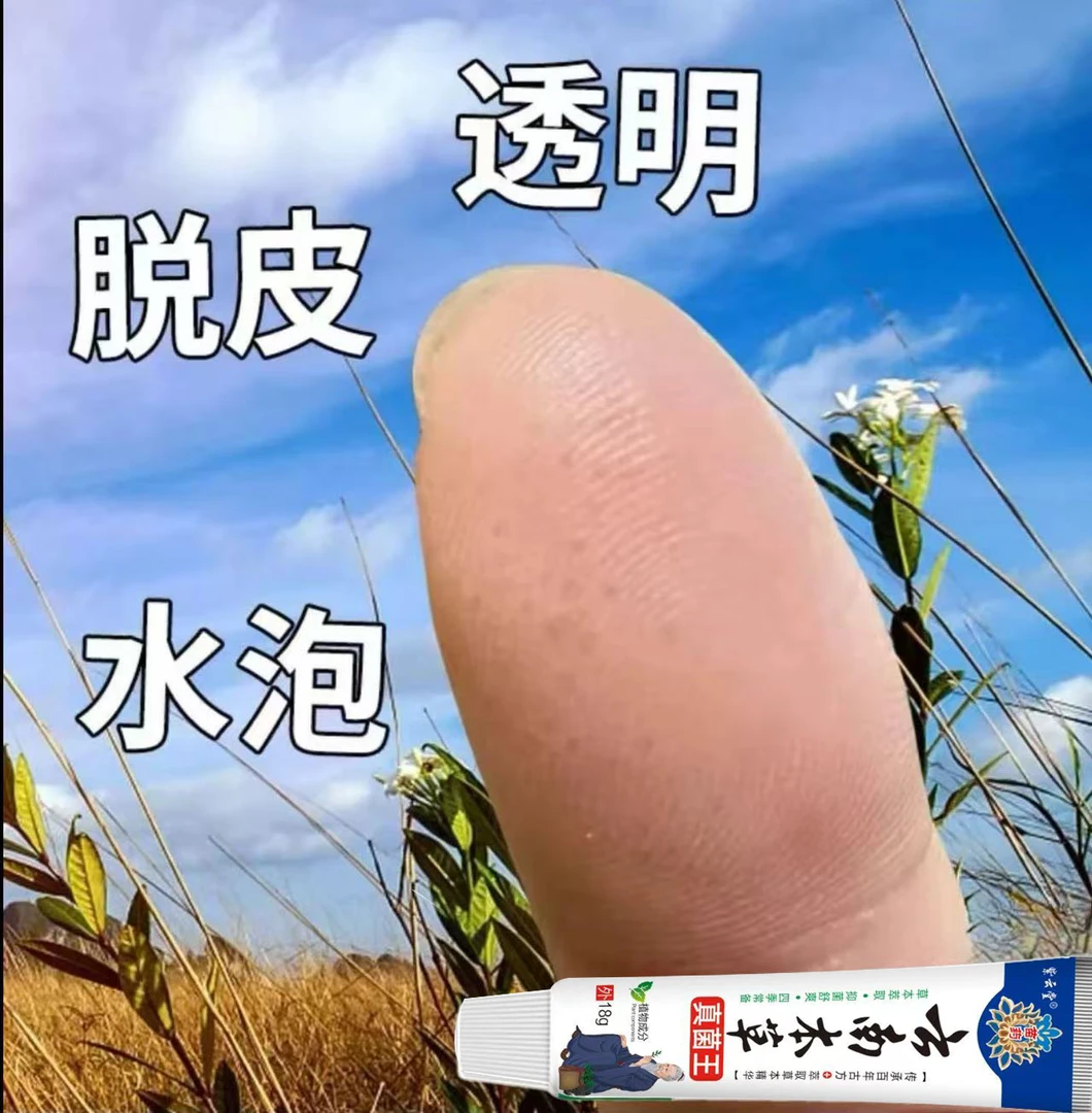云南本草手上红起小水泡手痒脱皮汗状灭菌止痒手起水泡痒的止痒膏