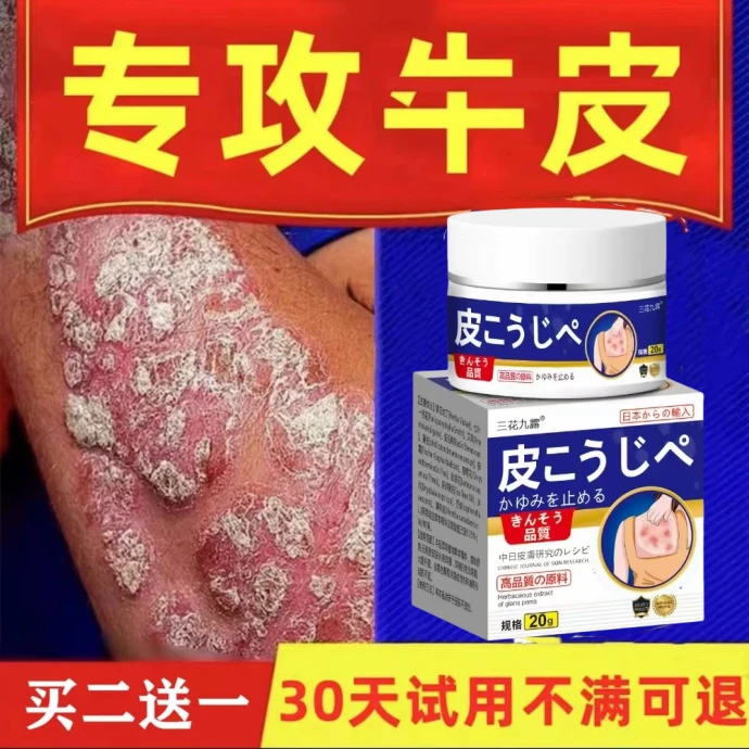 4银屑牛皮膏顽固牛皮肤痒鳞屑手足红点大腿内侧痒止痒草本抑菌膏