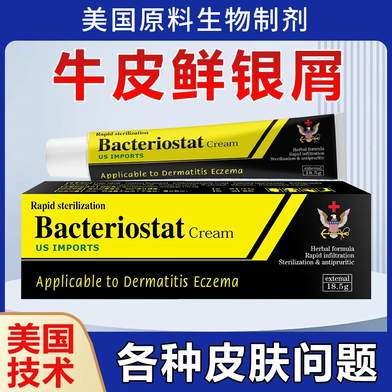 【美国牛皮膏】银屑牛皮生物制剂专用止痒膏头皮手足外用真菌乳膏