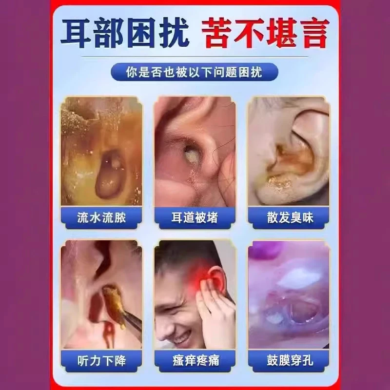 滴耳液人用耳朵痒耳鸣中耳耳道流黄水耳部清洁液耳痒滴耳油