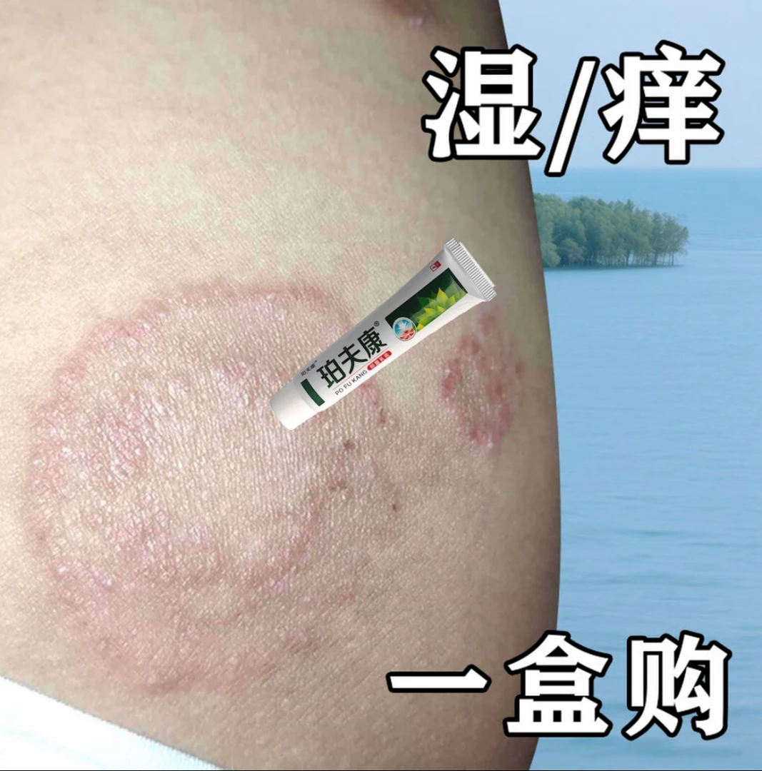 牛皮专用膏银屑头鲜手足鲜手鲜足鲜银屑掉屑外用皮肤痒草本止痒膏