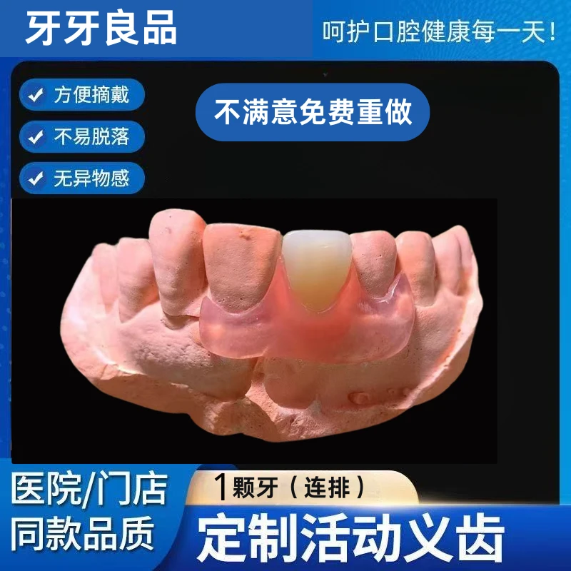 1颗牙牙科同款门牙缺牙隐形活动假牙定制
