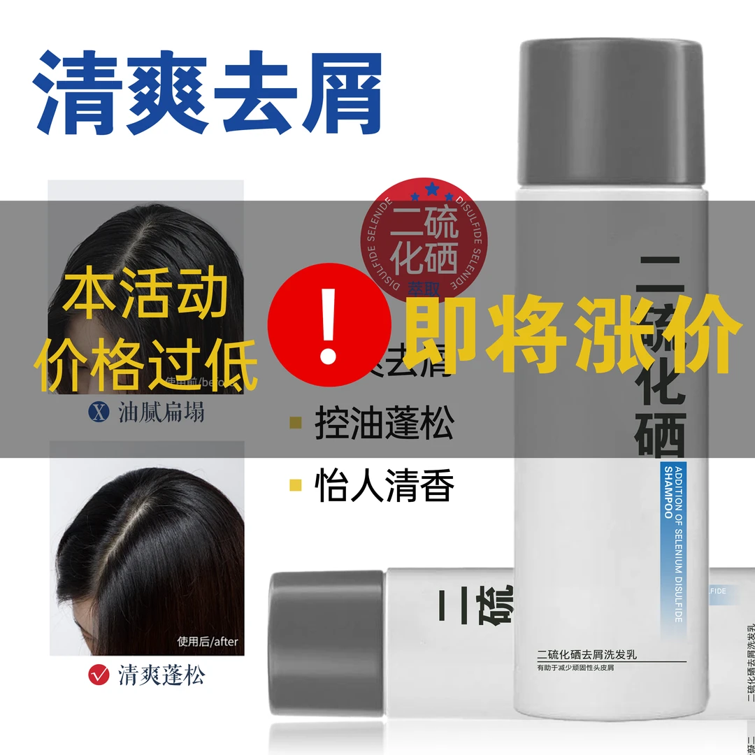 洗发水二硫化硒1%洗发乳持久去屑止痒控油蓬松去油清爽功效洗发露