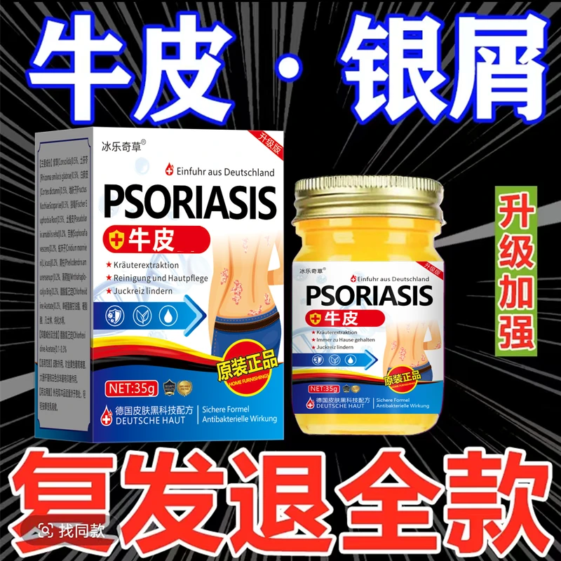 【德国牛皮膏】全身牛/皮/银/屑/鲜手足头体股大腿内侧草本止痒膏