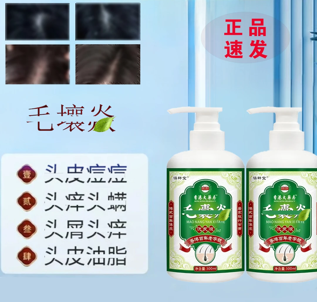 毛囊专用去屑止痒缓解头皮瘙痒应对脂溢性皮痒