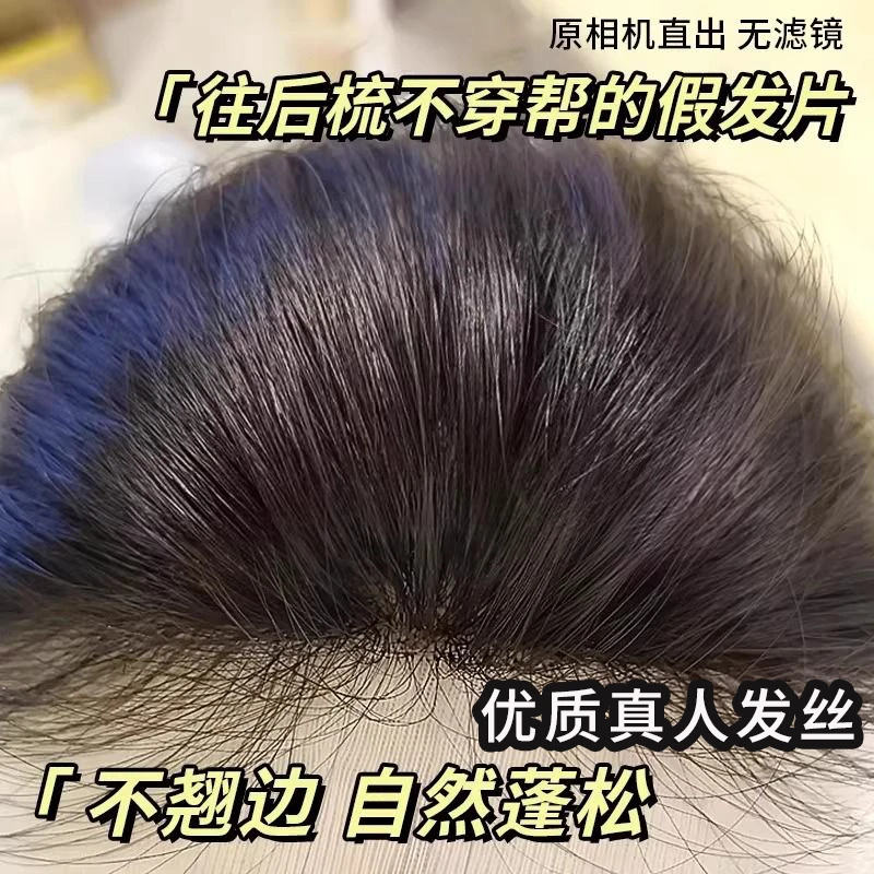 【店铺热销】假发女头顶增发补发蓬松高颅顶遮白发轻薄刘海假发片