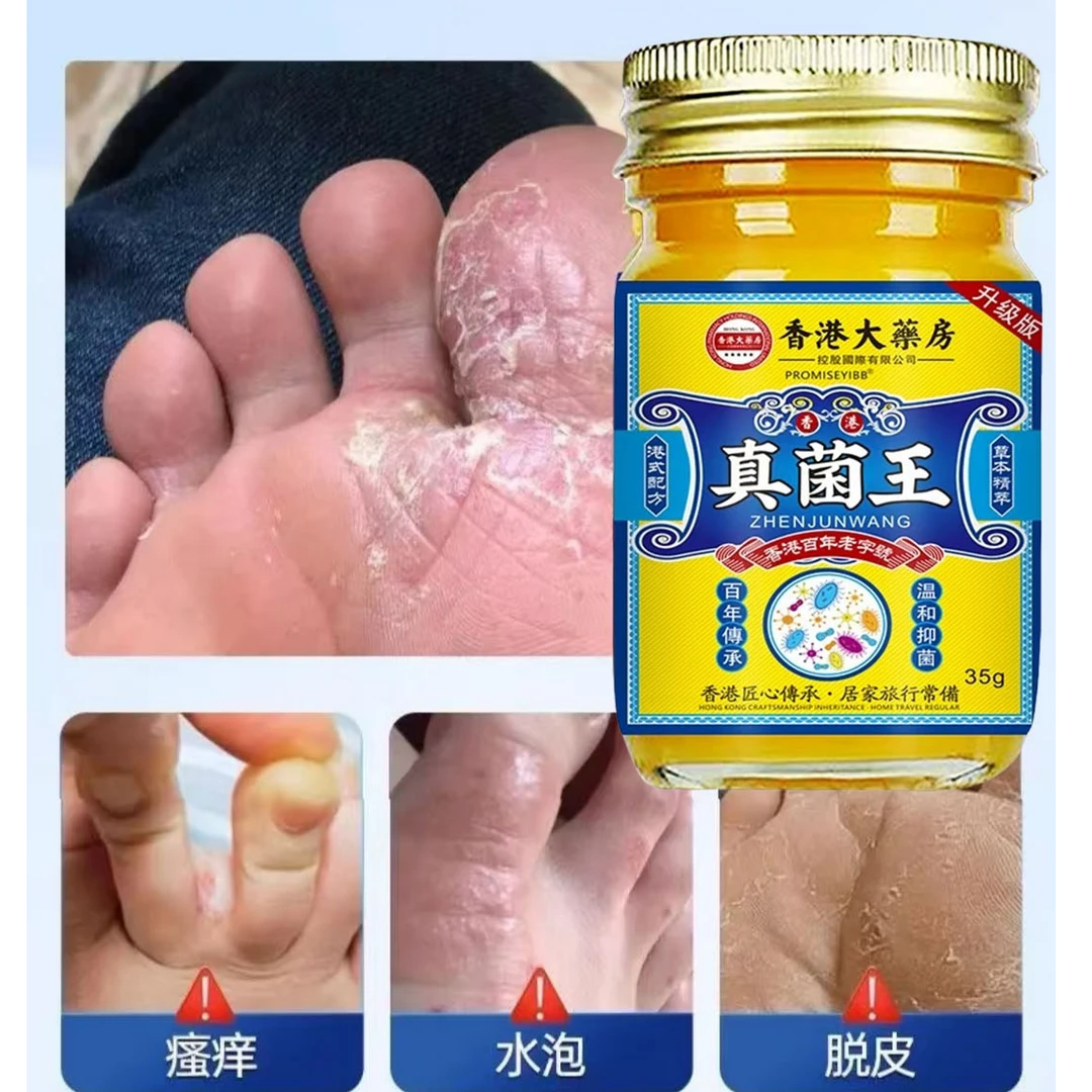 香港真菌王手脚起小水萢止痒膏脚趾缝烂痒脱皮抑菌开裂克星痒专用