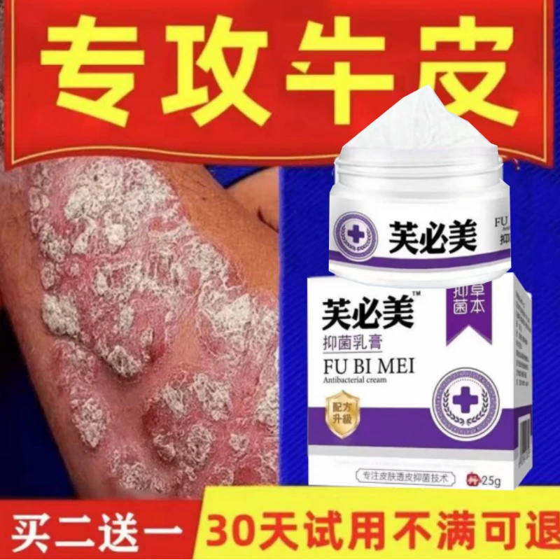 拍一发三】银屑牛皮膏顽固牛皮肤痒鳞屑手足红点大腿内侧痒止痒膏