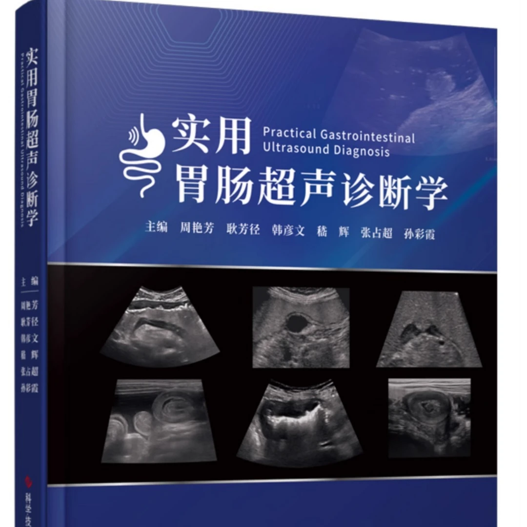 实用胃肠超声诊断学 周艳芳 胃肠病超声波诊断