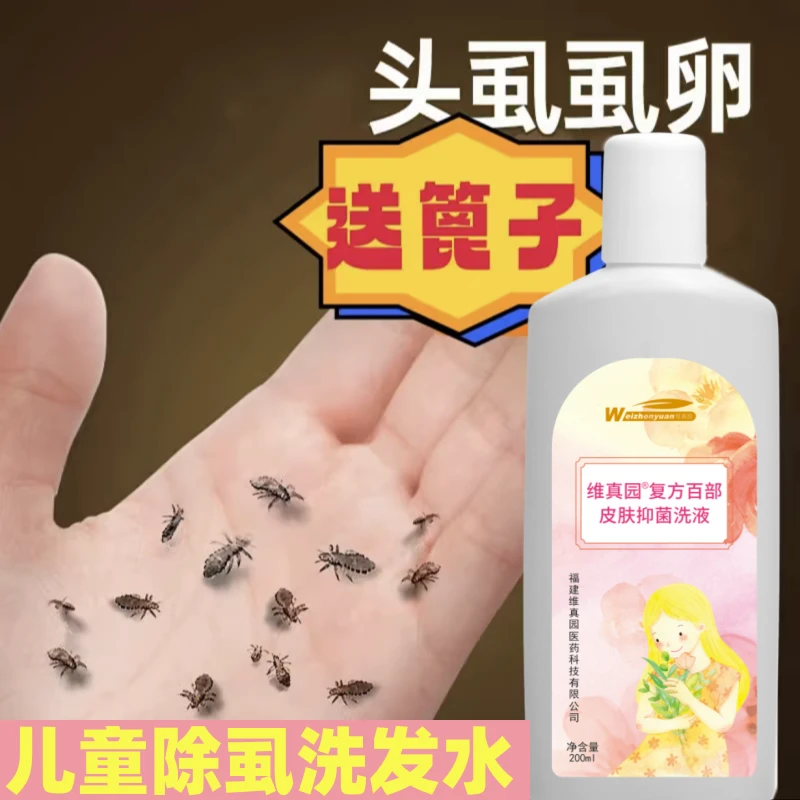 儿童头虱子百部酊小女孩头发上长的虱子卵洗发水大人用除头虱香波