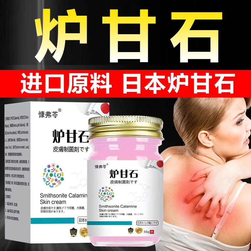 慷弗苓炉甘石成人儿童止痒膏全身干痒皮肤抑菌止痒湿痒专用舒缓膏