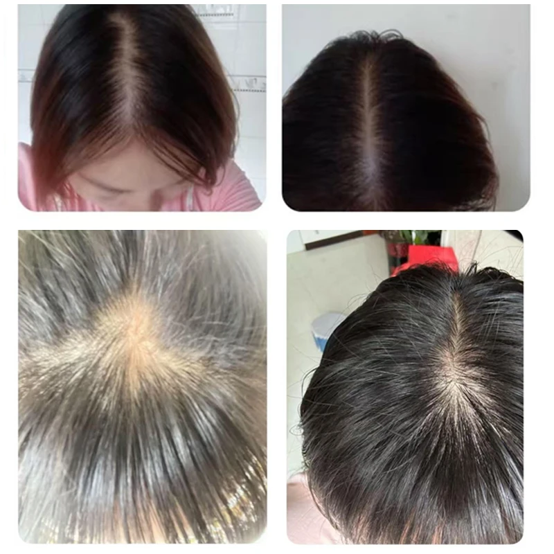 用户真实反馈！！食用前后对比，新粉可以看过来