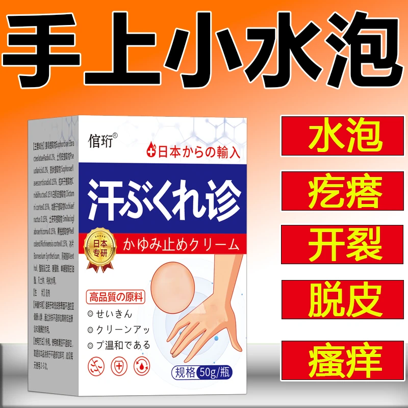 汗泡诊专用手上起小水泡止痒膏脱皮抑菌手指缝痒干裂专用草本乳膏