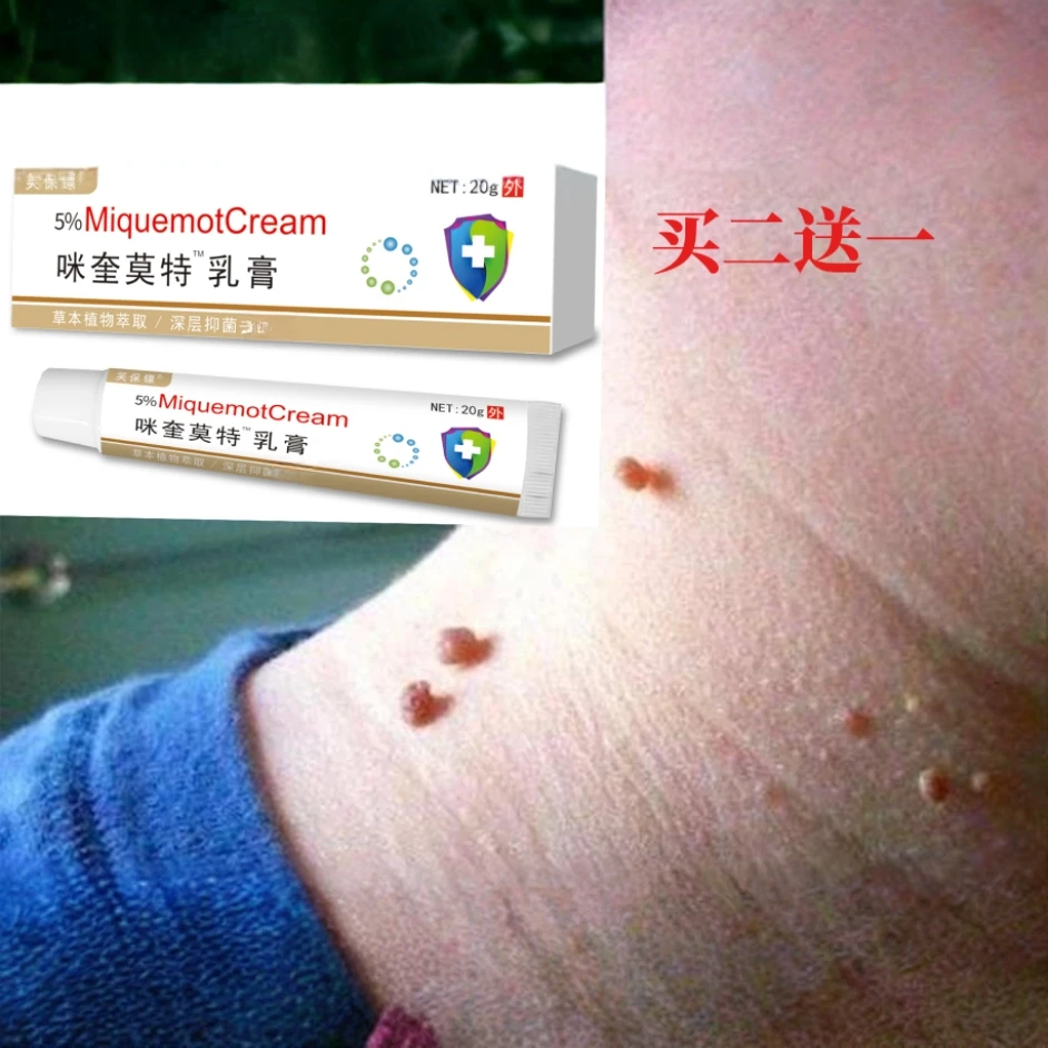 官方正品祛痘祛釉咪奎抑菌5%软膏 国民大品牌值得信赖