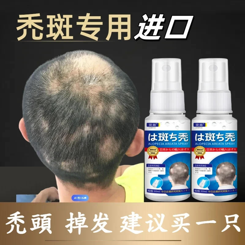 鬼剃头谢顶秃顶防脱突发斑性秃营养液特效鬼剃头特育发效生姜发根