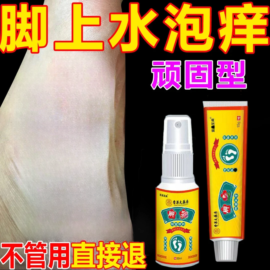 脚痒脚臭止痒膏去脚出汗脱皮起水泡干裂脚趾缝痒喷剂抑菌止痒神器