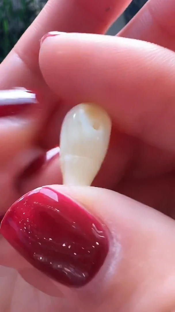 裸石蜜蜡未镶嵌9+蜜蜡精工瓷白蜡三通