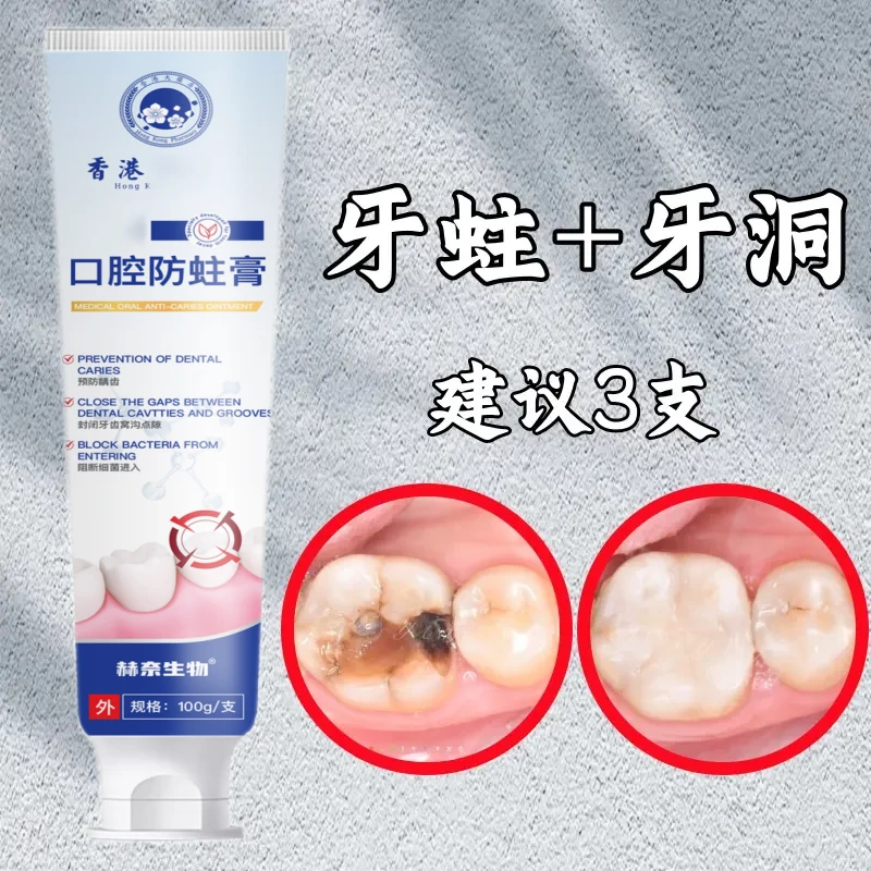 【香港出品】蛀牙专用|牙洞牙黄牙黑敏感|大牌护理牙膏