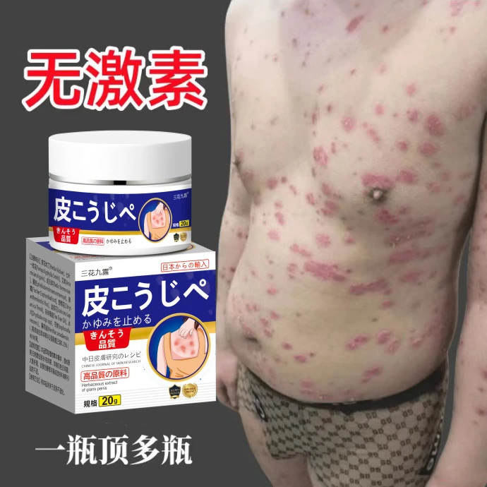 火疖子断痒拔毒消肿屁股红肿硬块脓包拔脓膏痘痘坐板疮毛囊拔毒膏