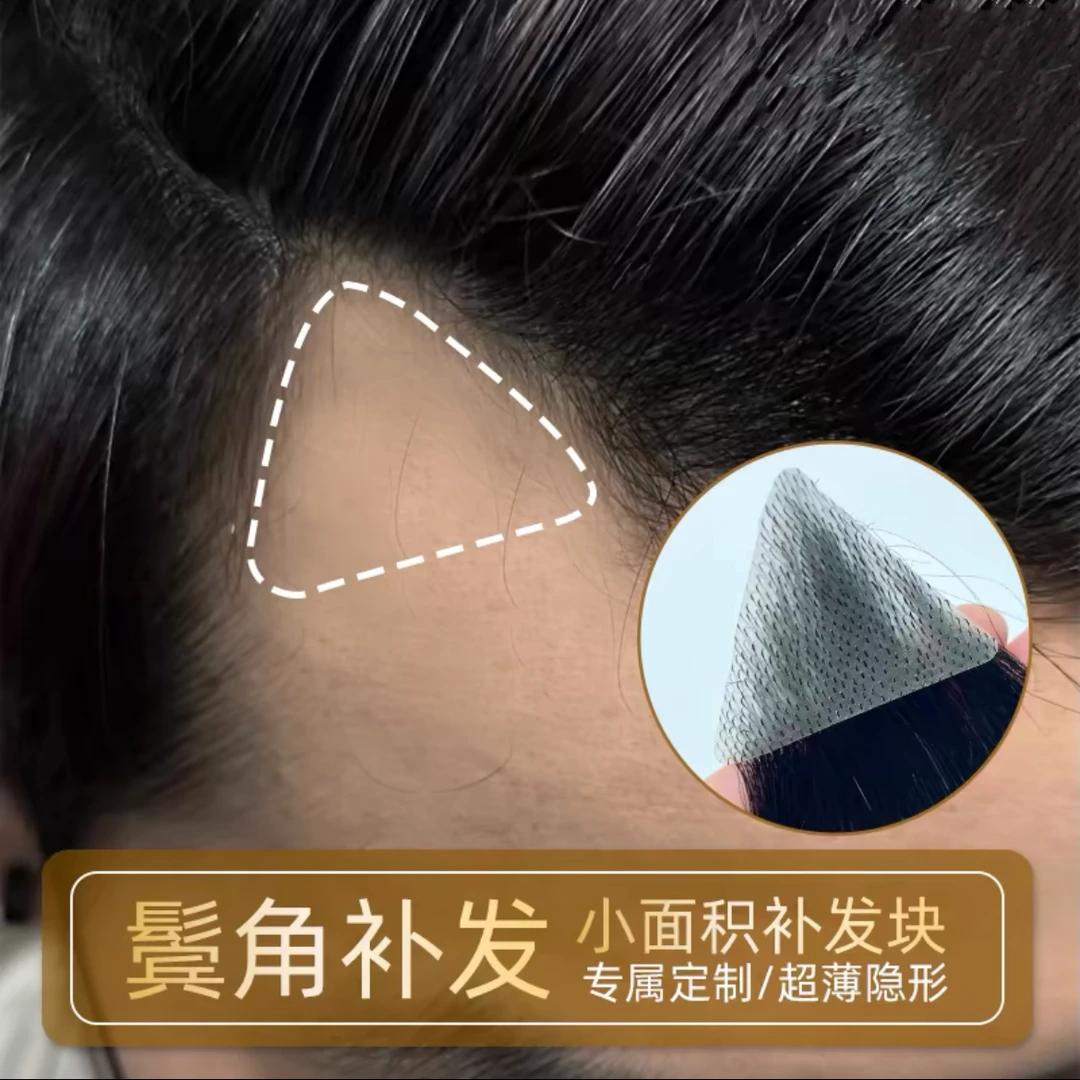 女士鬓角补发片通用真人发鬓角贴片遮白增发量一片式鬓角假发片