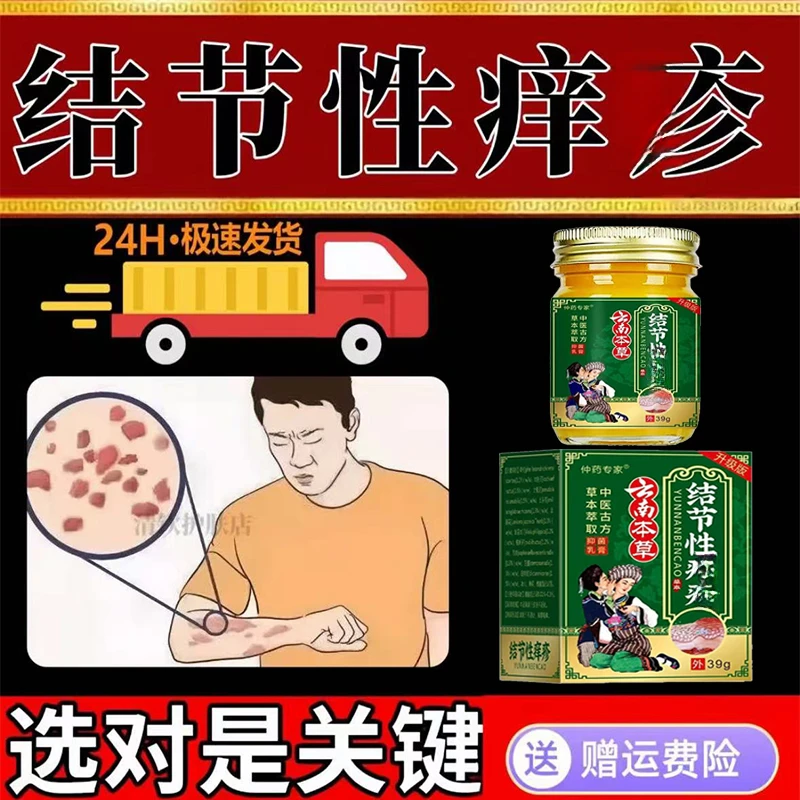 结节性痒诊止痒去顽固硬疙/瘩手脚头部全身结节疙瘩无激素乳膏