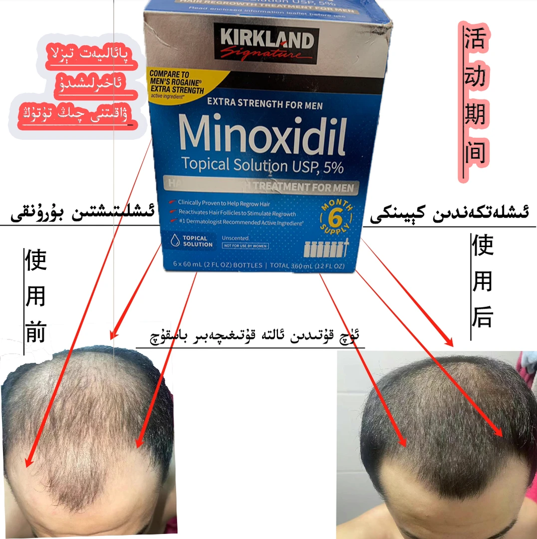 KIRKLAND  Signature/科克兰美国进口Minoxidil(5%) 生发养发护发