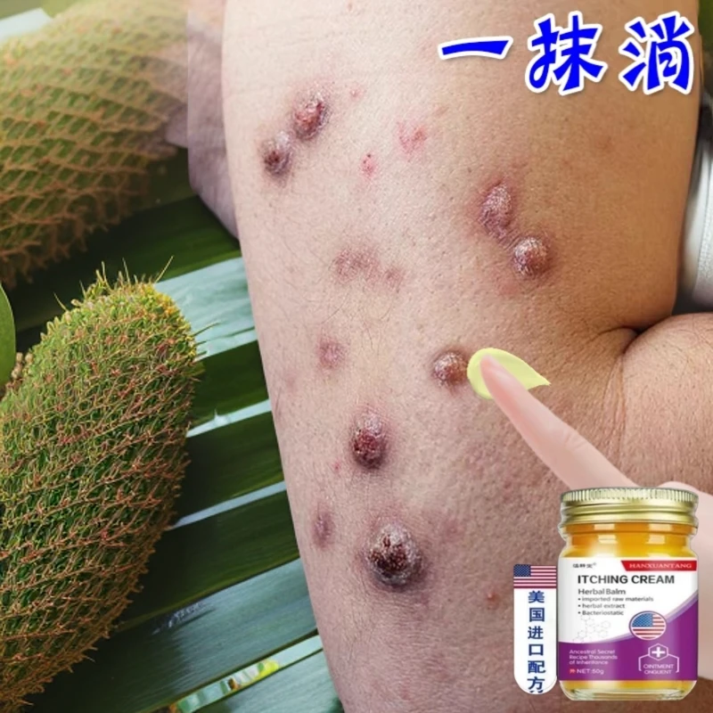 结节性痒疹止痒膏草本抑菌外用乳膏舒缓皮肤瘙痒抑菌膏