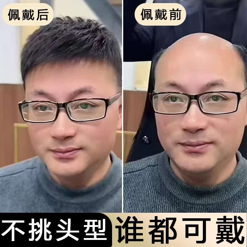 男士假发定制补发片前额头发际线刘海片头顶补发秃顶全短发真发
