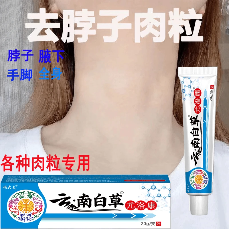 【小肉粒专用】顽大夫正品云南白草克尤膏脖子手足腋下丝状扁平肉刺