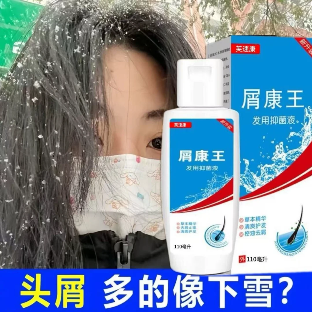 屑康王去屑止痒严重头屑止痒正品头皮屑头痒控油男女螨虫洗发露