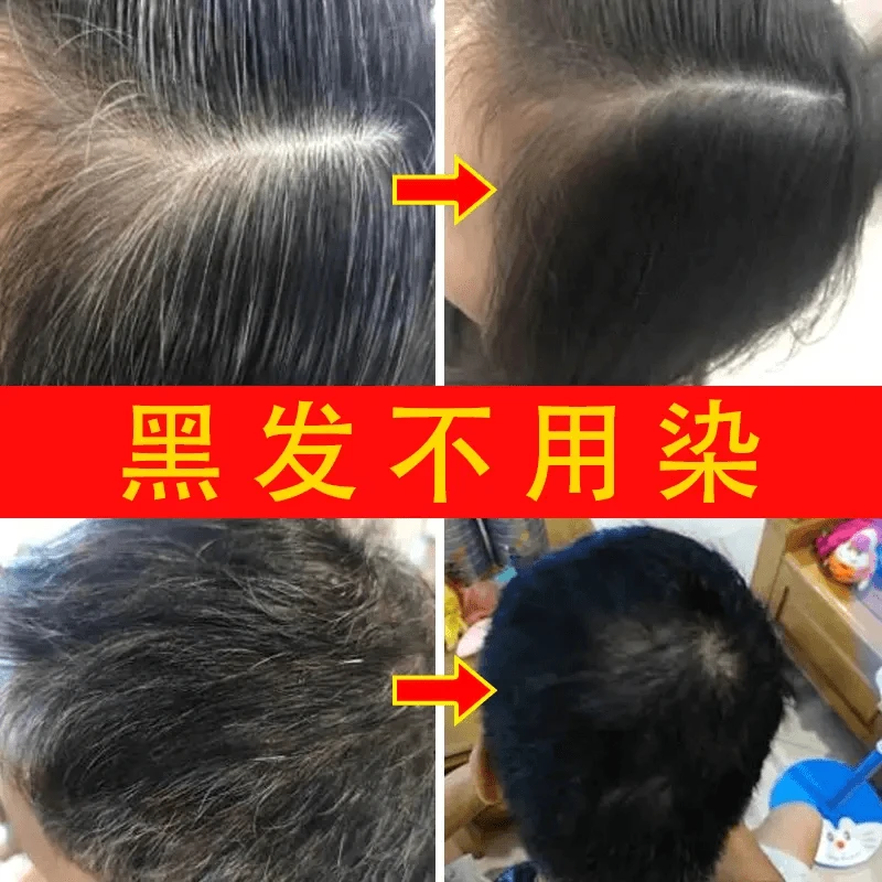 【无科技狠活】香港大薬房墨旱莲侧柏叶纯手工精油皂洗发皂养护发