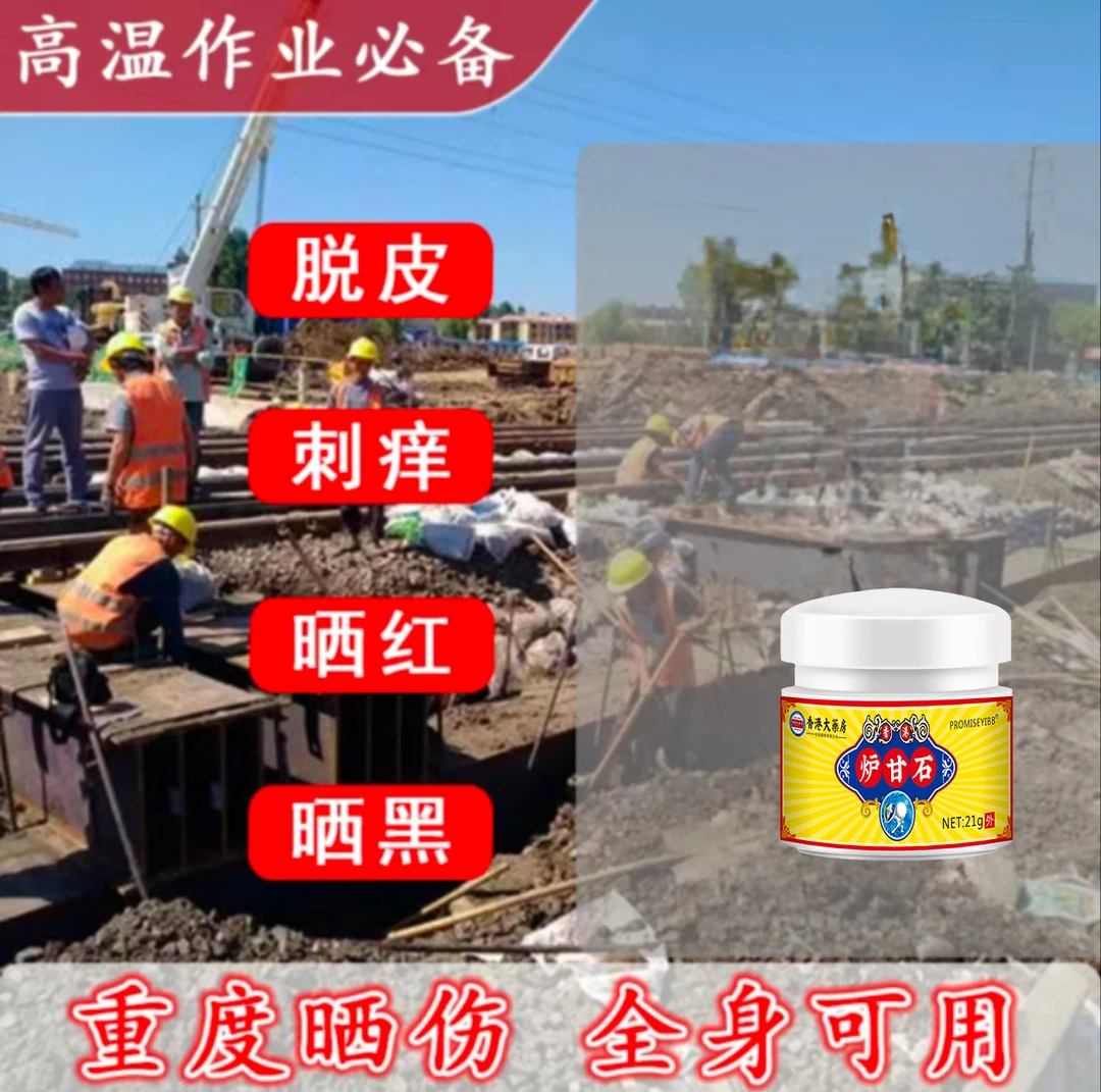 【儿童可用】晒伤膏晒后修复脸手脖子背部防紫外线日光性蜕皮止痒