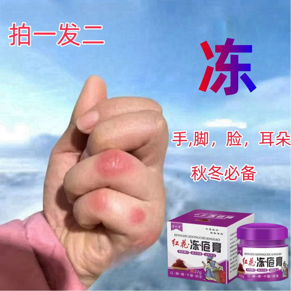 （拍一送一）冻手冻脚膏冻裂膏防冻膏防干裂冻耳朵脸部润肤止痒保湿