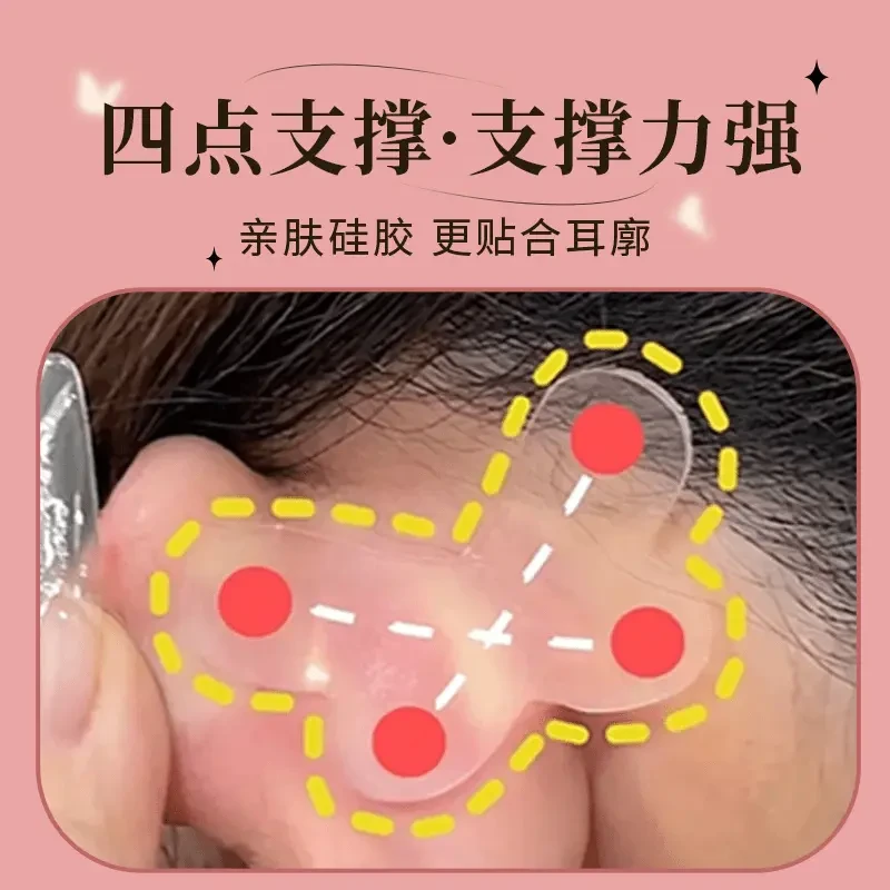 【四点定位支撑】升级蝴蝶型精灵神器定型耳贴耳朵支撑矫正器显脸小