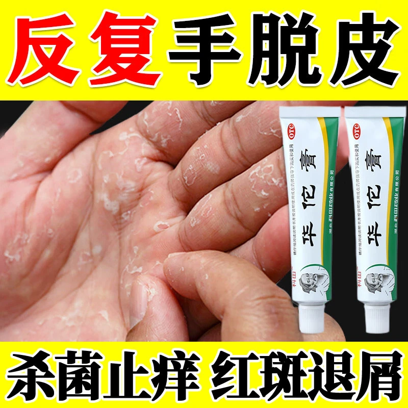 科田治鹅掌风药膏手癣症皮肤真菌感染杀菌止痒  华佗膏10g