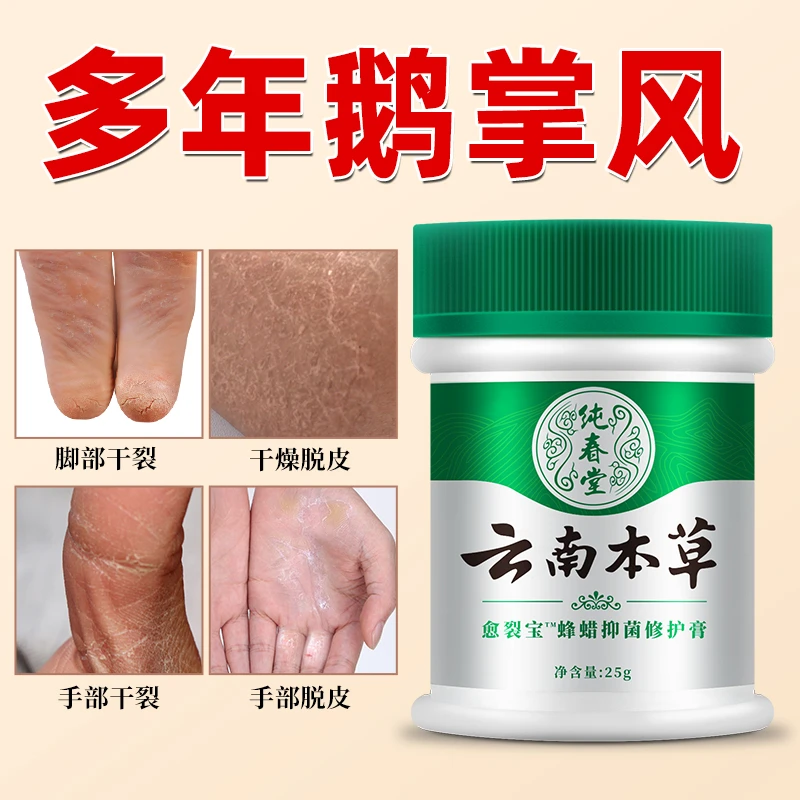 鹅 掌风手足裂口脱皮发痒手上干裂脱皮止痒草本抑菌软膏