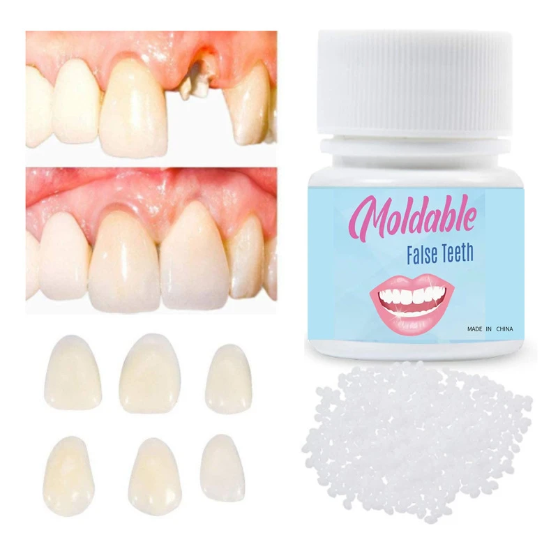 【新疆包邮】新型树脂牙洞临时修补神器20ml装