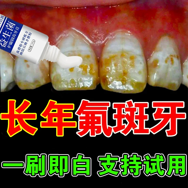 氟斑牙去牙黄去氟牙渍烟渍龋齿修复清新提亮益生菌修护牙膏