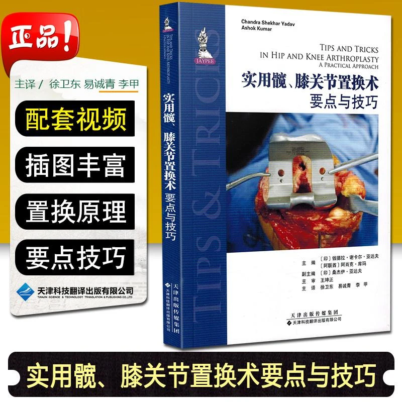 实用髋 膝关节置换术 要点与技巧9787543339668 天津科技翻译出版