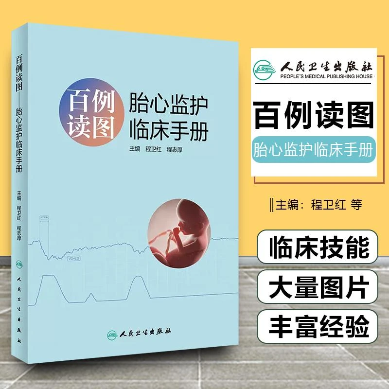 百例读图 胎心监护临床手册  人民卫生出版社 9787117331494