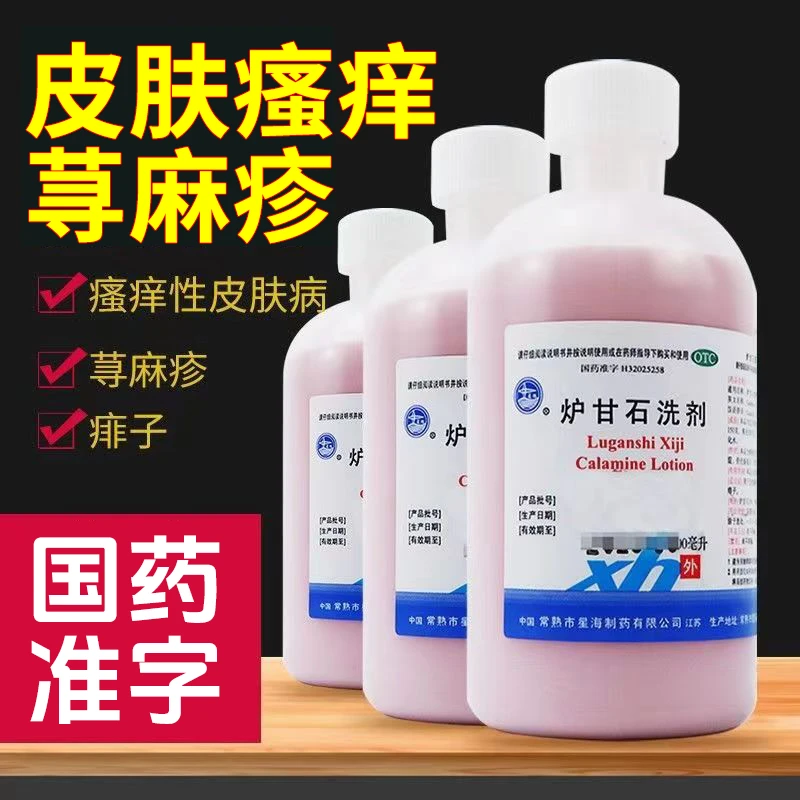 星海急性荨麻疹痱子瘙痒性皮肤病清洗药 炉甘石洗剂100ml