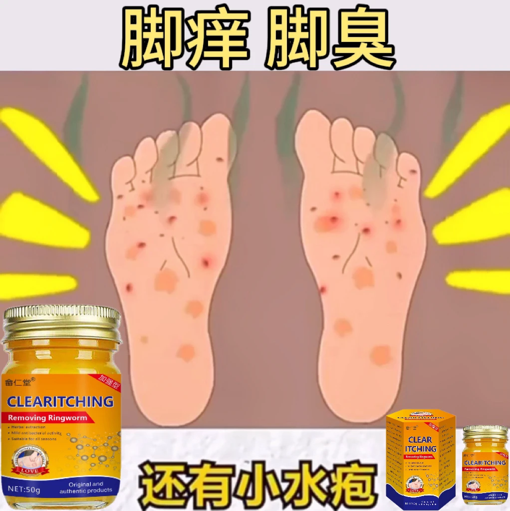 脚痒脚部越抓越痒专用止痒膏起红点脱皮神器乳膏周身草本植物萃取